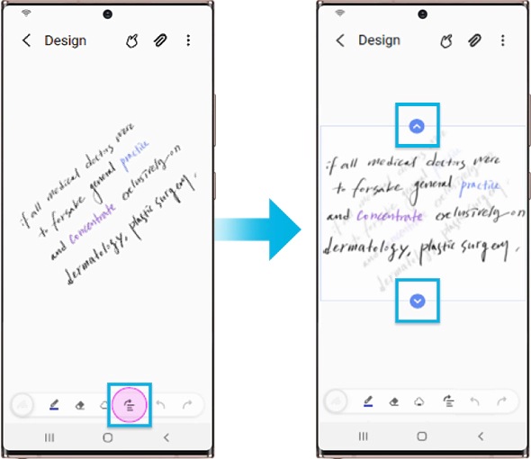How to use automatic alignment