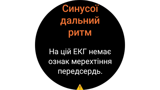 Екран результатів вимірювання ЕКГ на Galaxy Watch.