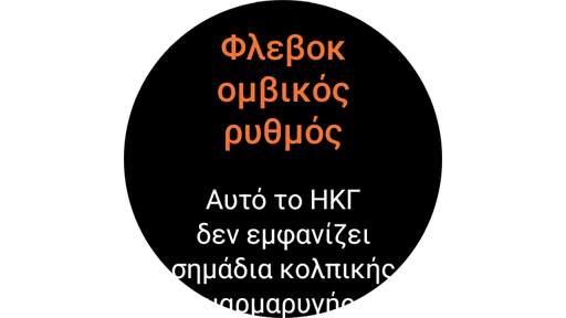 Οθόνη αποτελεσμάτων μέτρησης ΗΚΓ σε ένα Galaxy Watch.