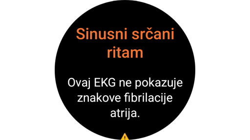 Zaslon s rezultatima mjerenja EKG-a na Galaxy Watch satu.