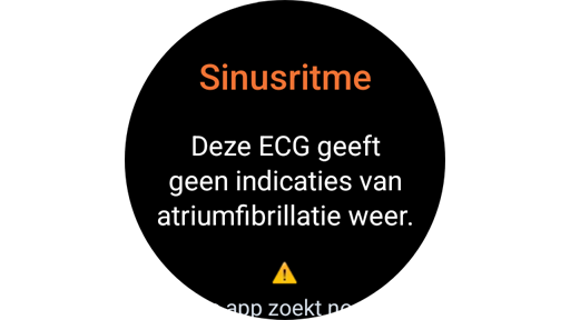 Scherm met ecg-meetresultaten op een Galaxy Watch.