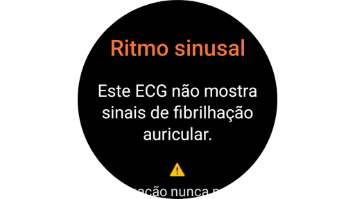 Ecrã de resultados de medição de ECG num Galaxy Watch.