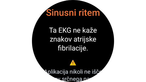 Zaslon z rezultati merjenja EKG v uri Galaxy Watch.