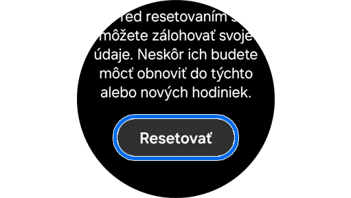 Vysvetlenie toho, čo sa stane, keď resetujete svoje hodinky Galaxy Watch s možnosťou pokračovať.
