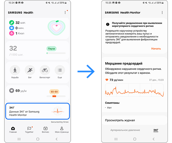 Просмотр данных об ЭКГ через Samsung Health
