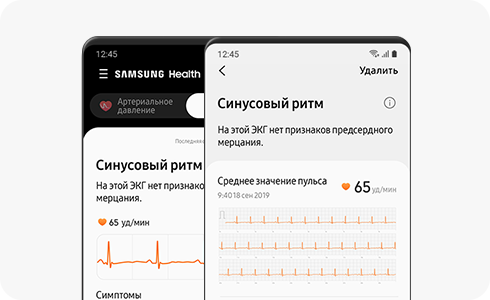 ЭКГ, Samsung Health Monitor