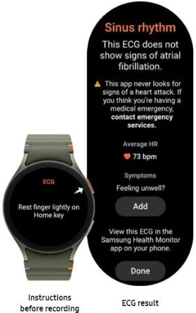Recording ECG using a Galaxy Watch