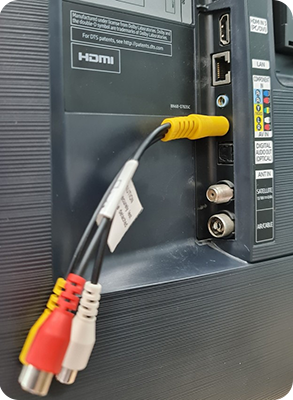 RCA