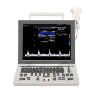 SONOACE R3 Front White