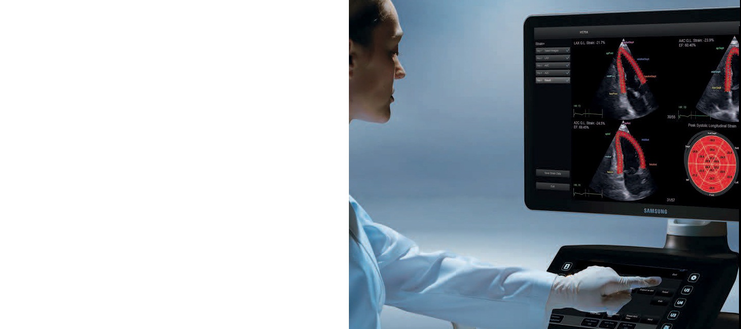 Ultrasonografy Samsung znajdują także zastosowanie w medycynie - z inspiracji kardiologów powstał echokardiograf HS70A with Prime