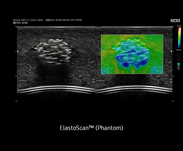 ElastoScan™ w przenośnym aparacie USG to technologia ultradźwiękowa umożliwiająca obrazowanie elastyczności tkanek