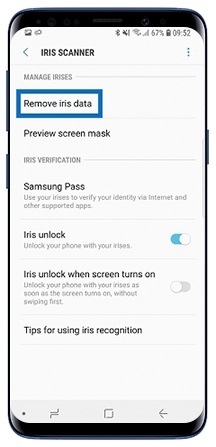 Remove iris data