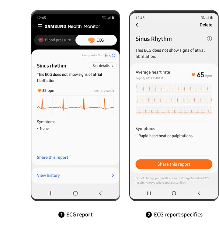 Četrti korak uporabe elektrokardiograma (EKG-ja) je ‚Pregled poročil o EKG-ju na Galaxy napravi‘. Galaxy napravi, prikazani druga ob drugi. Leva Galaxy naprava prikazuje zaslon z rezultati EKG-ja. Desna Galaxy naprava prikazuje podrobne informacije na zaslonu z rezultati EKG-ja. Pod obema Galaxy napravama vidimo besedilo, ki opisuje oba zaslona.