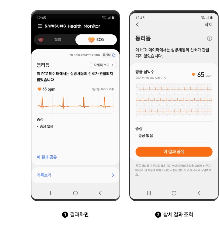 ECG 측정 후 결과화면과 상세 결과 조회를 나타내는 디바이스의 GUI 화면