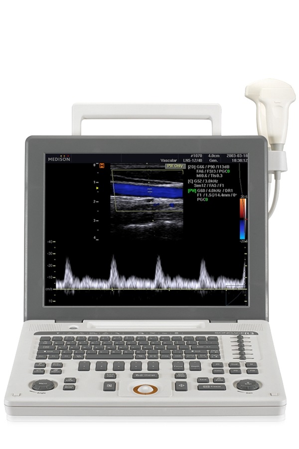 SONOACE R3 | Assistance Samsung FR