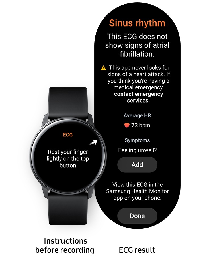 eletrocardiograma galaxy watch