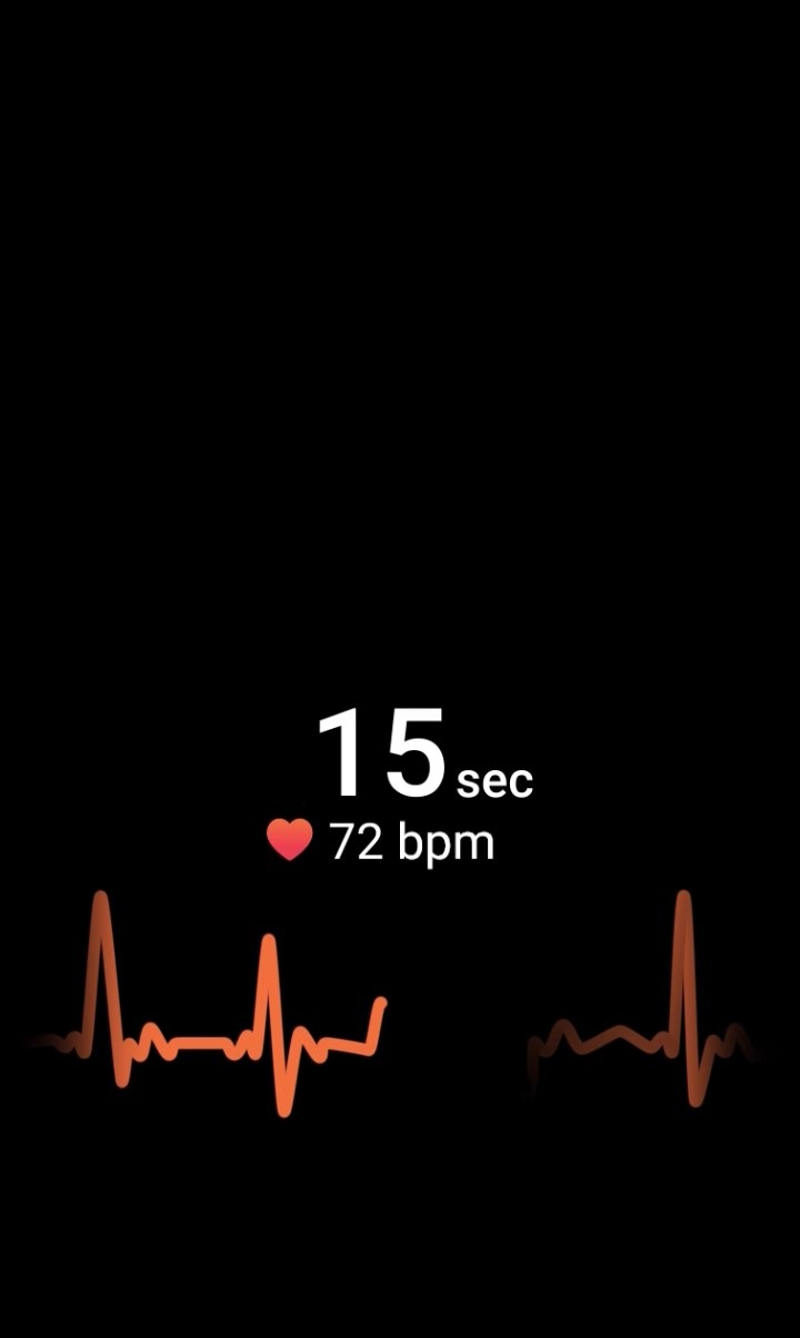 In this graphic user interface of the ECG, the duration time decreases from 15 seconds to 10 seconds. The BPM starts at 72 and fluctuates. The ECG graph below rises and falls.