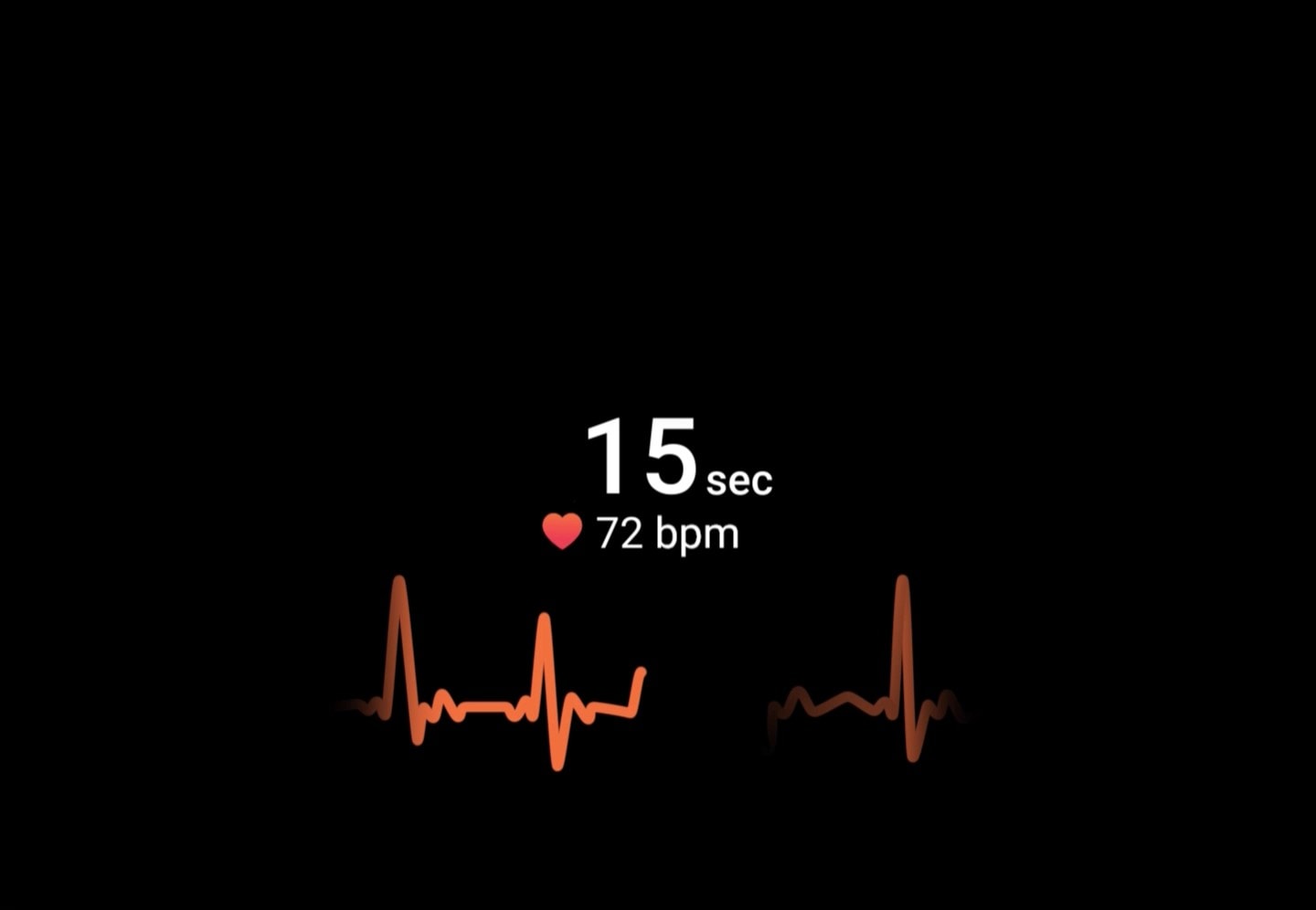 In this graphic user interface of the ECG, the duration time decreases from 15 seconds to 10 seconds. The BPM starts at 72 and fluctuates. The ECG graph below rises and falls.