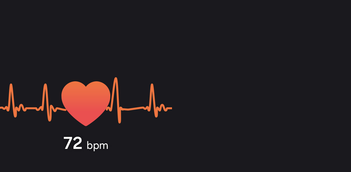 심전도 그래프 모양과 함께 '72bpm'이라고 쓰여 있습니다.